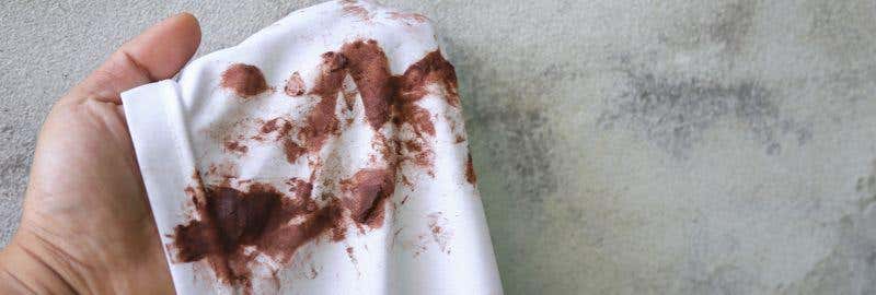 O Mistério das Manchas Antigas: É Possível Salvar? - inspiração 1