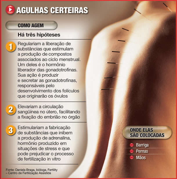 Como a Acupuntura Pode Transformar o Tratamento da Dor Crônica