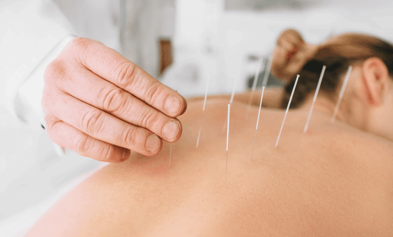 Descubra os Benefícios da Acupuntura Auricular para o Bem-Estar