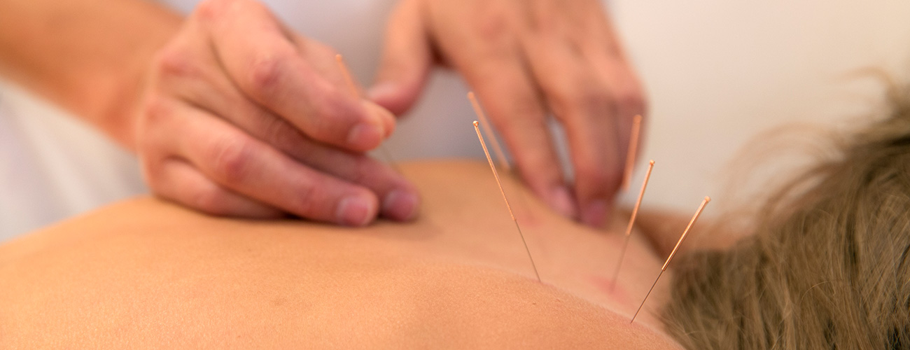 Acupuntura e Saúde Mental: Aliviando Ansiedade e Depressão com Agulhas