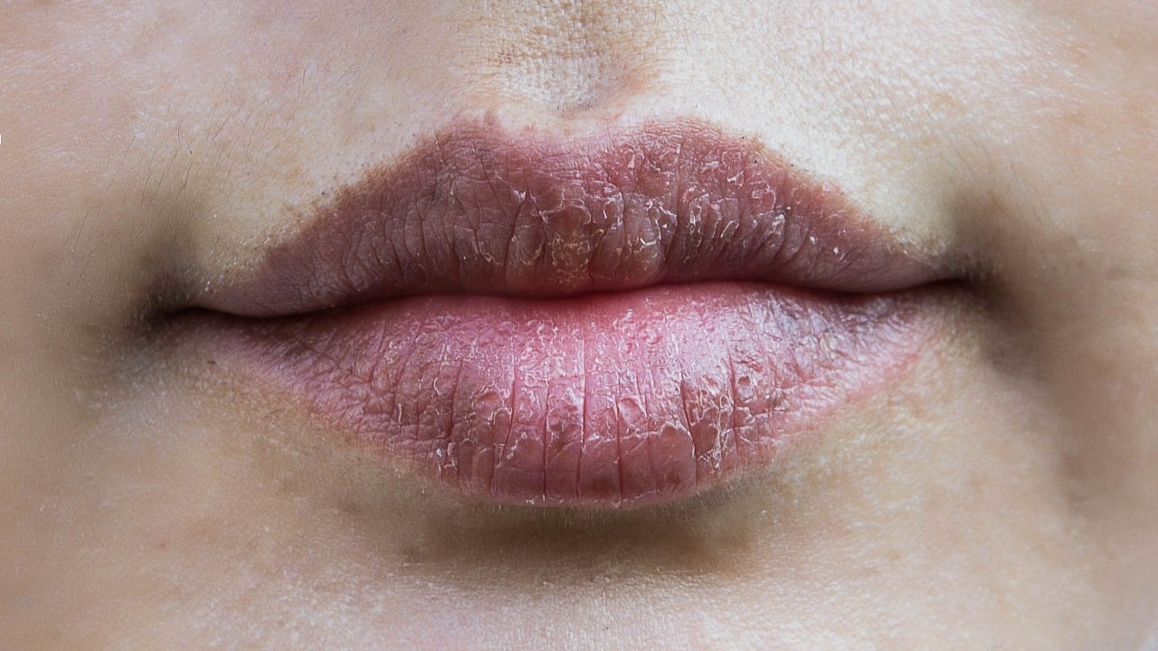 melhores hidratantes labiais naturais para labios ressecados