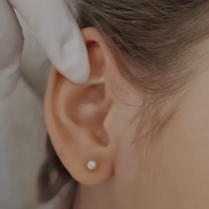 furo de orelha humanizado o que é