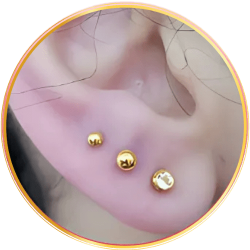 1. Furo de Orelha Humanizado vs. Tradicional: Qual a Diferença?
2. Guia Completo: Como é Feito o Furo de Orelha Humanizado em Bebês?
3. Benefícios do Furo de Orelha Humanizado para Adultos
4. Profissionais Habilitados para o Furo de Orelha Humanizado: O Que Saber?
5. Cuidados Pós-Furo de Orelha Humanizado para uma Cicatrização Perfeita