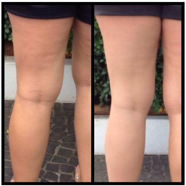 Meia-Calça Líquida vs. Maquiagem Corporal Tradicional: Qual a Melhor Opção?