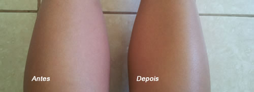 Como Disfarçar Varizes e Estrias com Maquiagem para Pernas: Produtos e Técnicas