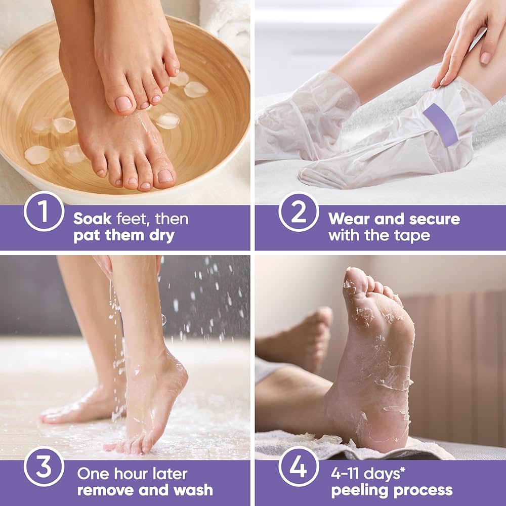 meias esfoliantes foot peel