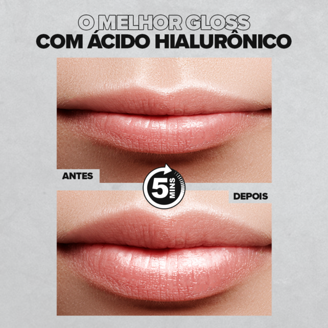 Cuidados com os lábios após usar gloss com efeito de aumento