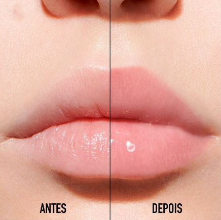 Cuidados com os lábios após usar gloss com efeito de aumento