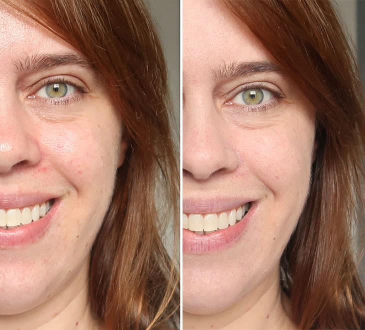 melhores protetores solares com cor para pele oleosa