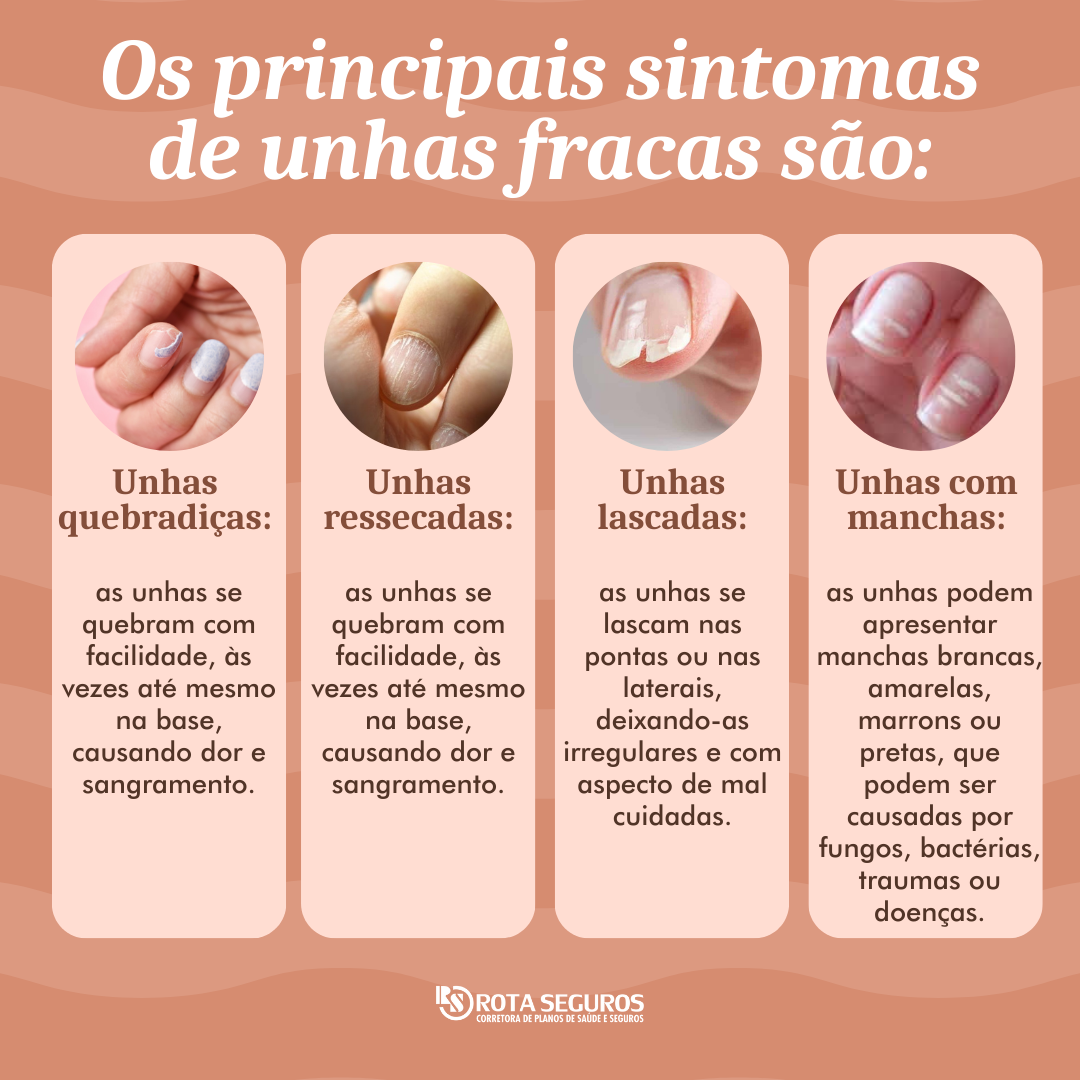unhas fracas e quebradiças (dicas de cuidado)