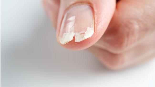 Guia Completo: As Melhores Bases Fortalecedoras para Unhas Fracas